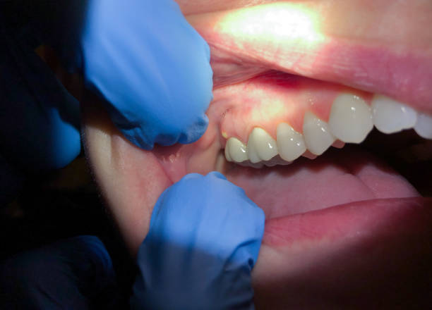 Professional Emergency Dental Service in CA