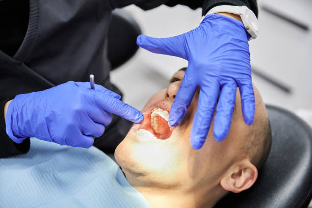 Best Dental Abscess Treatment in East Bakersfield, CA